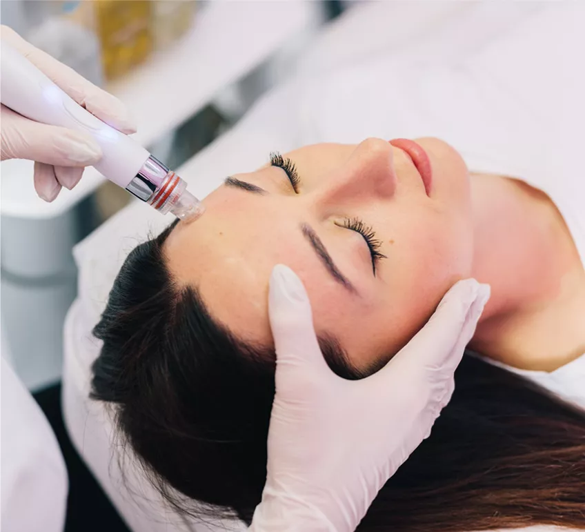 Especialista realizando un tratamiento de microneedling con dispositivo led en el rostro de una paciente
