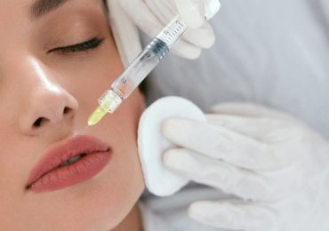 Proyección de Labios: Definición, Procedimiento y Ventajas